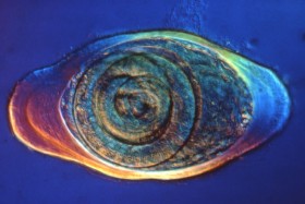 Trichinella